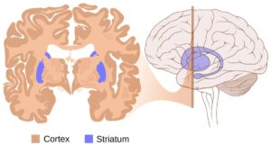 découvrez tout sur la maladie de huntington : principaux symptômes, causes sous-jacentes et options de traitements disponibles. informez-vous pour mieux comprendre cette maladie neurodégénérative et ses impacts sur la vie quotidienne.
